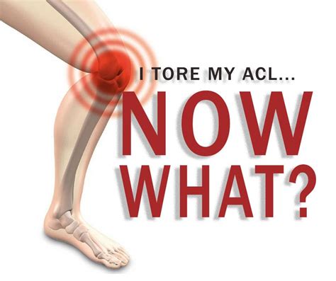 I Tore My Acl… Now What Coury And Buehler Physical Therapy