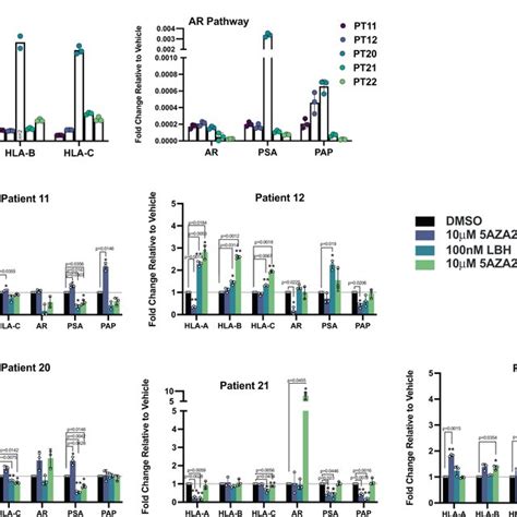 HLA I Expression And Response To DNMT And HDAC Inhibition Ex Vivo A