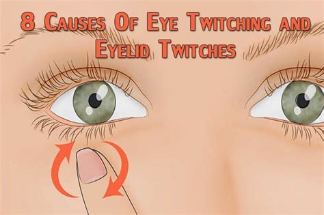 8 Causes Of Eye Twitching And Eyelid Twitches Places To Visit Cool Photos Eye Twitching