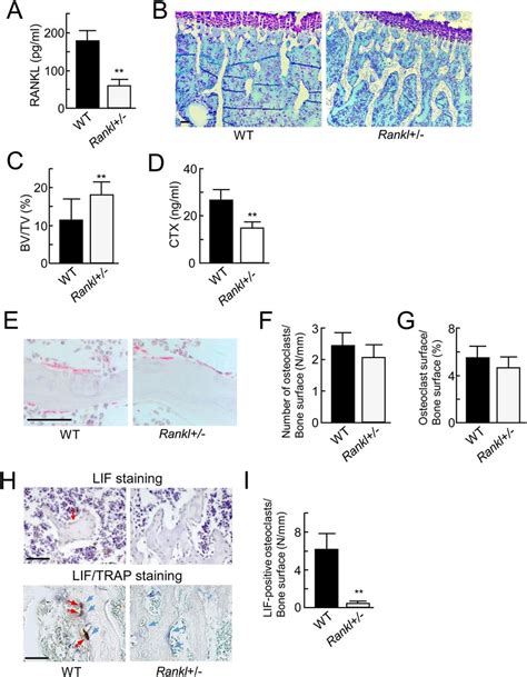 Bone Resorption And Lif Expression In Rankl Mice A Elisa