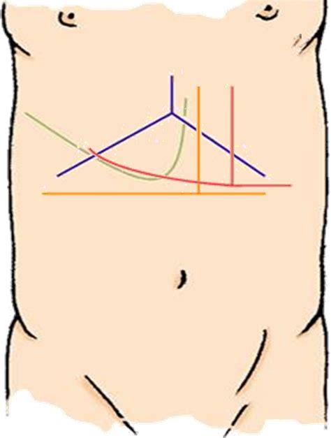 Segmental Oriented Liver Surgery Intechopen