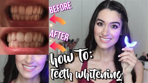 How I Whiten My Teeth Fast At Home With Glo Brilliant Youtube