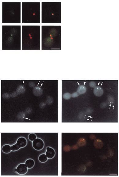 Bub3 GFP Foci Colocalize Predominantly With Kinetochores And Associate