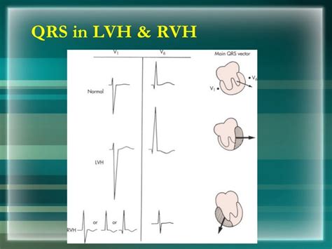 Ecg Basics