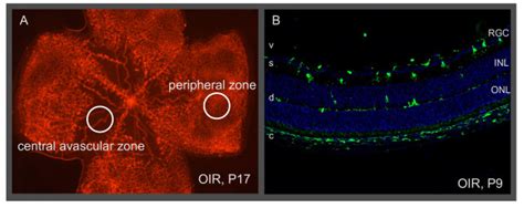 Retinal Zones And Layers Used For Quantifying Microglia A Retinal