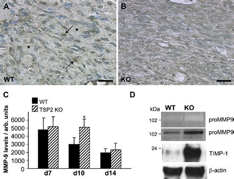 Increased Mmp In Day Tsp Null Wounds Representative Sections