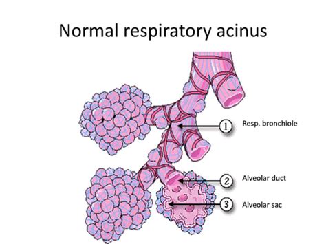 Pathophysiology Pulmonary Flashcards Quizlet