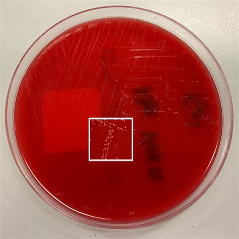 Growth Of Tiny White Colonies After 48 H On Horse Blood Agar Under