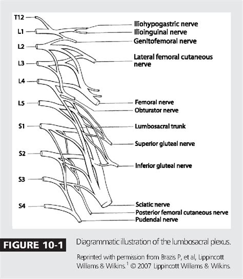 Figure 10 1 From Lumbosacral Plexopathy Semantic Scholar