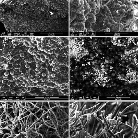 Schematic representation of biofilm structure, main species and ...