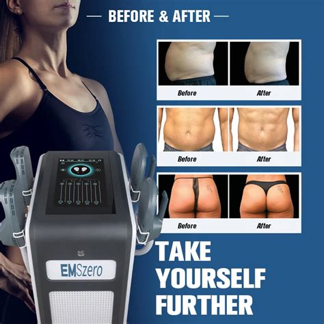 Emzero M Quina De Estimulaci N Muscular Para Esculpir El Cuerpo Emslim