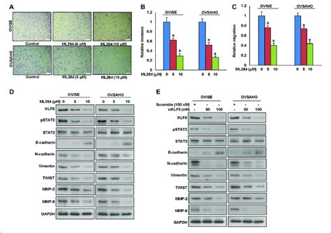 Inhibition Of Klf Decreases Invasion Migration And Progression Of