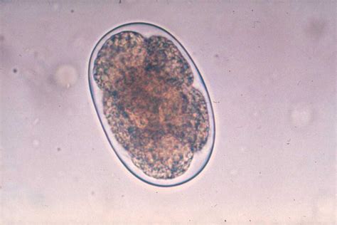 Uncinaria Spp Scheda Parassitologica Ed Approfondimenti