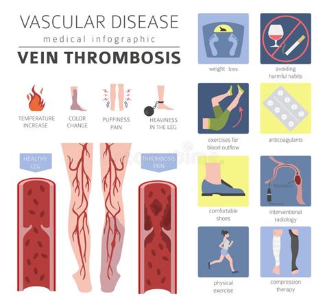 Vascular Diseases Vein Thrombosis Symptoms Treatment Icon Set Stock