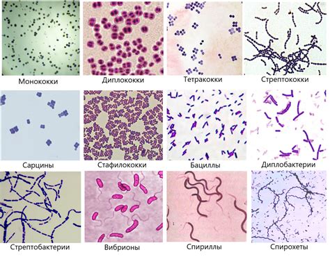 Формы бактерий | Биология - наука о жизни | Дзен