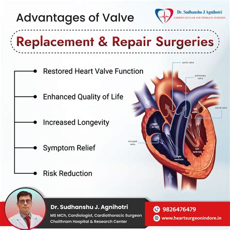 Dr. Agnihotri Your Trusted Heart Specialist Near Me