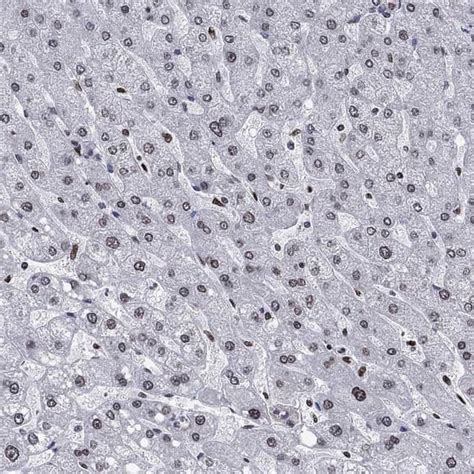 HMGA1 Antibody Novus Biologicals 100 μg Unconjugated Fisher Scientific