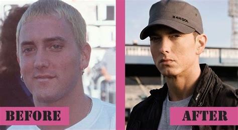 Eminem before and after plastic surgery 06 – Celebrity plastic surgery ...