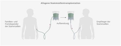 Stammzelltransplantation Beim Dlbcl Das K Wort