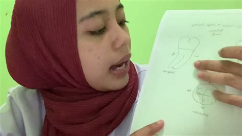 Dental Anatomi Siti Mujahadah Ridha Aulia Putri Penjelasan