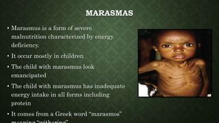 Effects of malnutrition in children | PPT