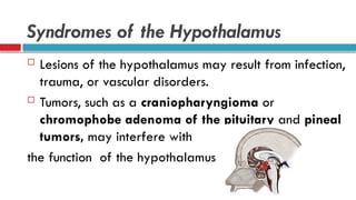 Cerebrum clinicals .Lesions of the Thalamus, Subthalamic Lesion Pineal ...