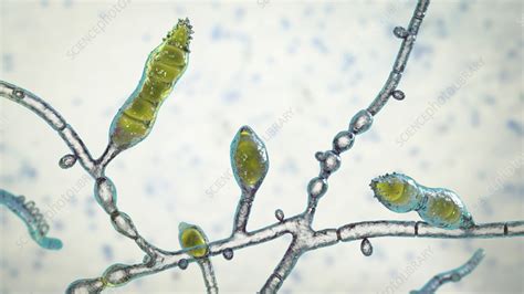 Microsporum audouinii fungus, illustration - Stock Image - F036/7212 ...