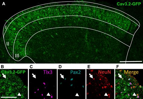 Gfp Immunofluorescence In The Spinal Cord Of The Adult Cav Gfp Flox