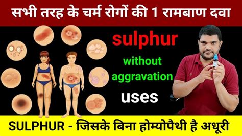 Sulphur Is A Homeopathic Medicine For All Skin Problems How To Use It