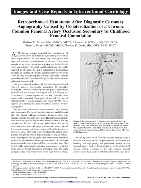 Pdf Retroperitoneal Hematoma After Diagnostic Coronary Angiography