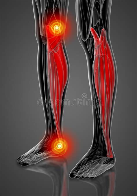 Medizinische Darstellung Des Gastrocnemius Stock Abbildung