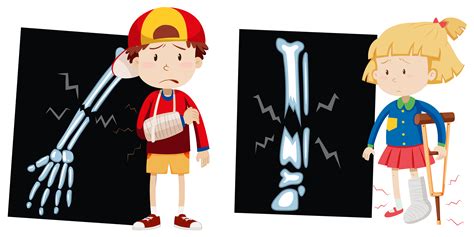 Bone Fracture Cartoon