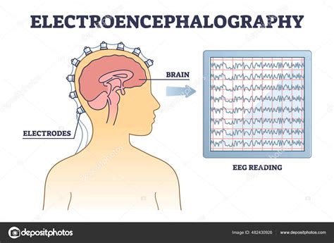 Electroencephalography Or Eeg As Brain Activity Monitoring Outline