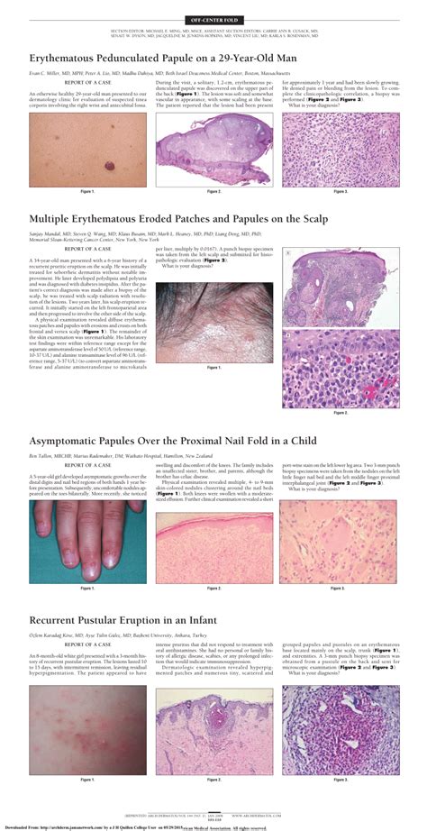 Pdf Recurrent Pustular Eruption In An Infant