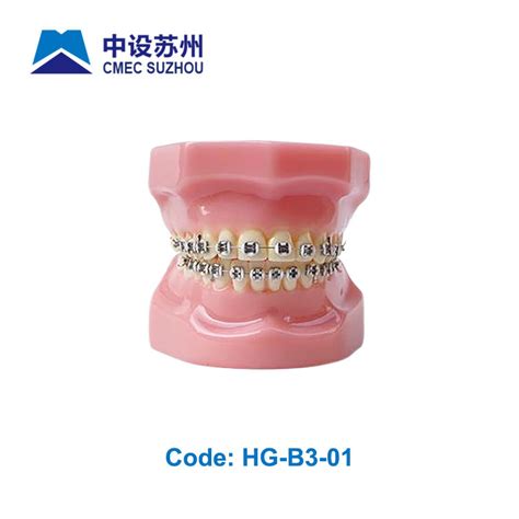 Orthodontic Connected Dental Oral Teeth Model With Metal Bracket Hg B