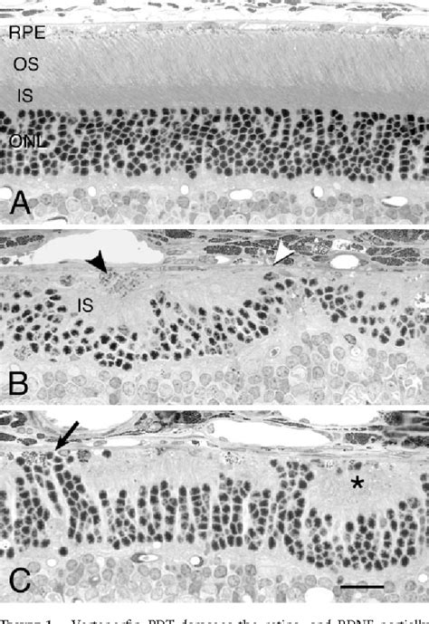 Figure From Bdnf Reduces The Retinal Toxicity Of Verteporfin