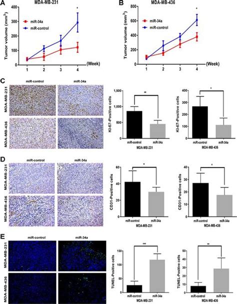 Dual Suppressive Effect Of Mir 34a On The Foxm1 Eef2 Kinase Axis