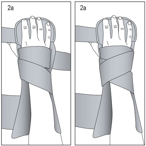 Hely Weber Tfo Fracture Orthosis Instruction Manual