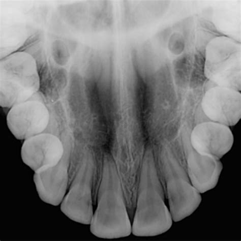 Radiografia Oclusal Unimagem Radiografia Odontológica Curitiba