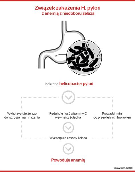 Bakteria Helicobacter Pylori A Anemia Gastroenterologia Termedia