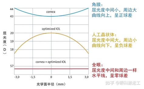 人工晶状体的非球面设计 知乎