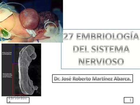 PPT 27 EMBRIOLOGÍA DEL SISTEMA NERVIOSO PowerPoint Presentation free