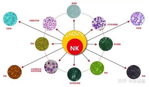 Nk细胞是怎么抵抗病毒感染的 知乎