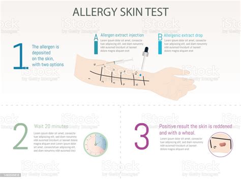 Allergy Skin Test Drop Or Intradermal Test And Process Stock ...