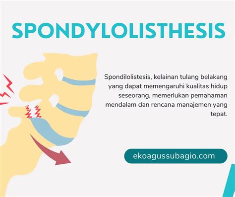 Mengenal Spondylolisthesis Penyebab Gejala Dan Pengobatan