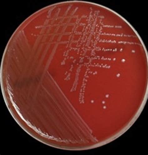 Solved What Is The Hemolysis Reaction For The Blood Agar Chegg