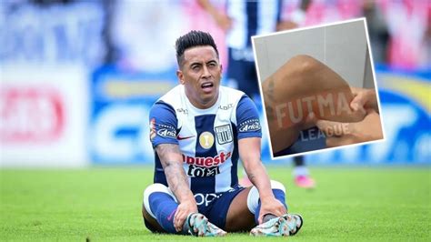 Christian Cueva Lesión El Tiempo De Recuperación Es Entre 6 Y 9 Meses Dijo Exmédico Selección