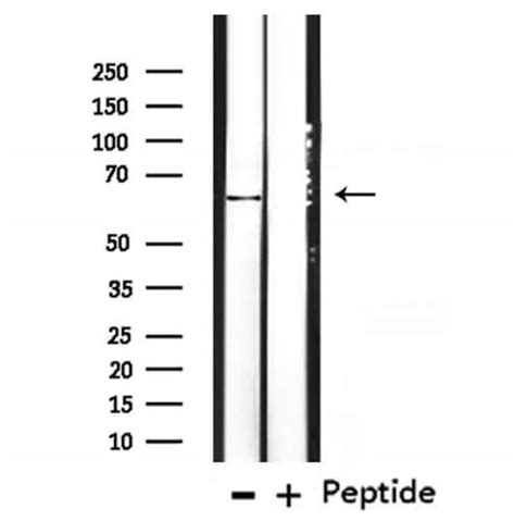 Cytokeratin 3 Polyclonal Antibody Invitrogen 100 μL Unconjugated