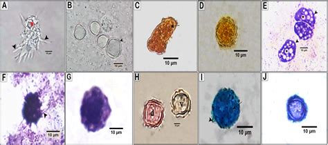 Acanthamoeba Cyst Morphology