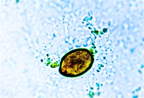 Premium Photo | Egg of intestinal fluke in human stool analyze by microscope